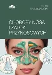 Choroby nosa i zatok przynosowych - tantis.pl