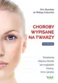 Choroby wypisane na twarzy - tantis.pl