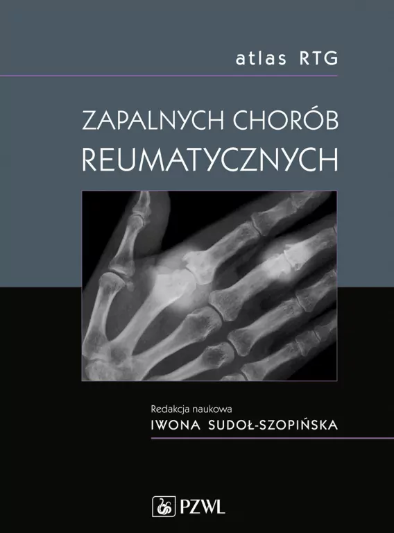 Atlas RTG zapalnych chorób reumatycznych - tantis.pl