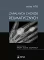 Atlas RTG zapalnych chorób reumatycznych - tantis.pl