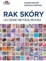Rak skóry. Leczenie metodą Mohsa - tantis.pl