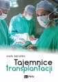 Tajemnice transplantacji - tantis.pl
