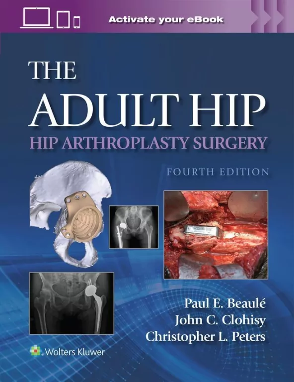 The Adult Hip: Hip Arthroplasty Surgery Print + eBook with Multimedia - tantis.pl