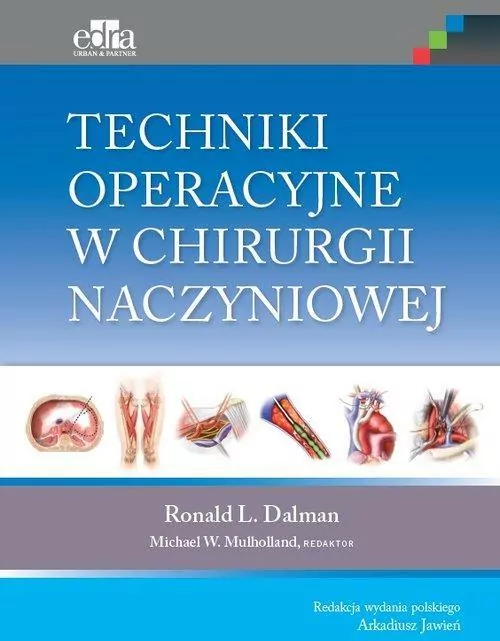Techniki operacyjne w chirurgii naczyniowej - tantis.pl