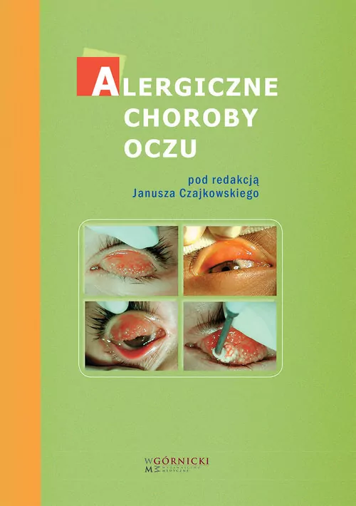 Alergiczne choroby oczu - tantis.pl