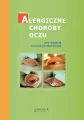 Alergiczne choroby oczu - tantis.pl