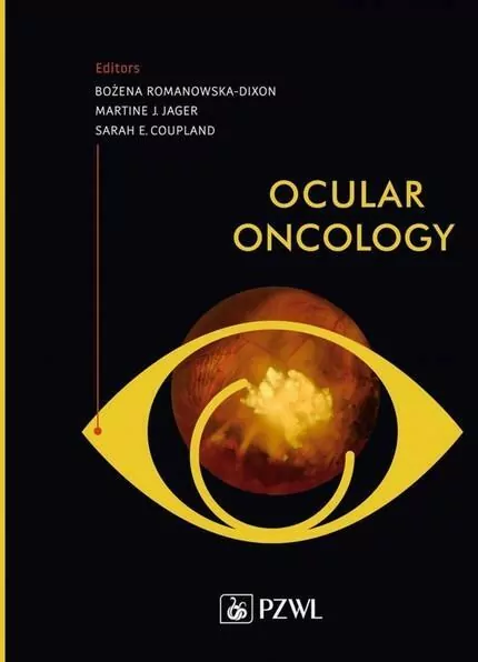 Ocular oncology - tantis.pl