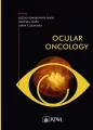 Ocular oncology - tantis.pl