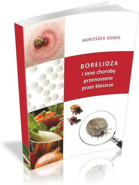 Borelioza i inne choroby przenoszone przez kleszcze - tantis.pl