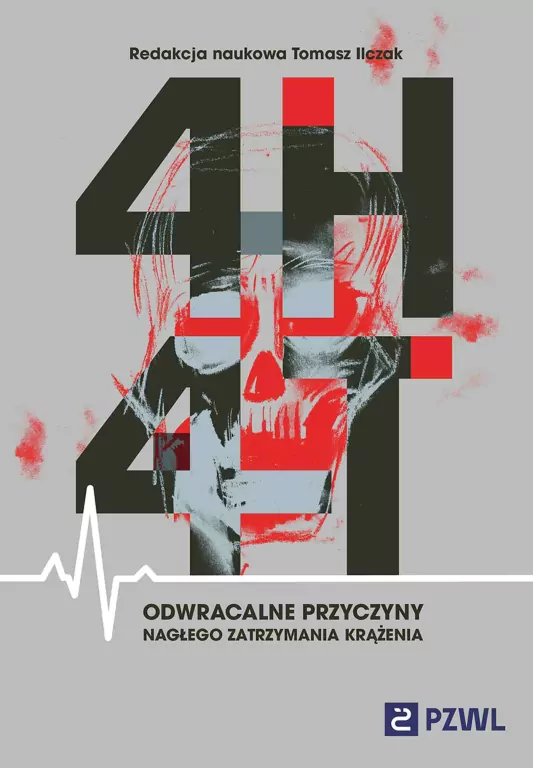 4H i 4T. Odwracalne przyczyny nagłego zatrzymania krążenia - tantis.pl
