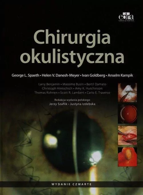 Chirurgia okulistyczna - tantis.pl