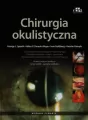 Chirurgia okulistyczna - tantis.pl