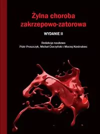 Żylna choroba zakrzepowo-zatorowa - tantis.pl