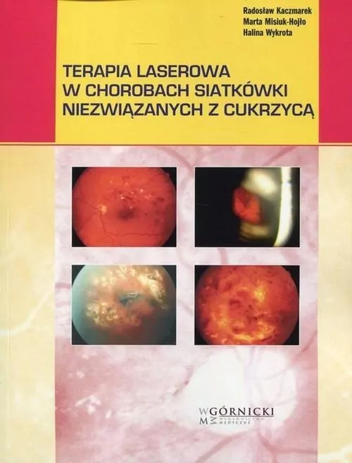 Terapia laserowa w chorobach siatkówki niezwiązanych z cukrzycą - tantis.pl