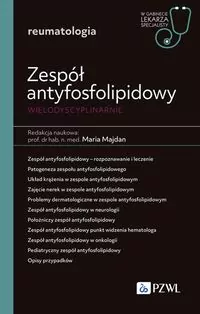 Zespół antyfosfolipidowy wielodyscyplinarnie - tantis.pl