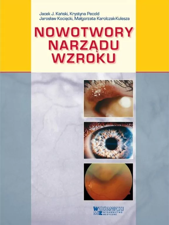 Nowotwory narządu wzroku - tantis.pl