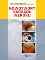 Nowotwory narządu wzroku - tantis.pl