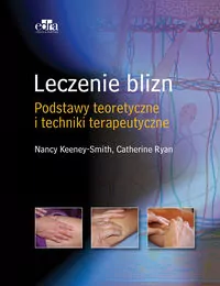 Leczenie blizn. Podstawy teoretyczne i techniki terapeutyczne - tantis.pl