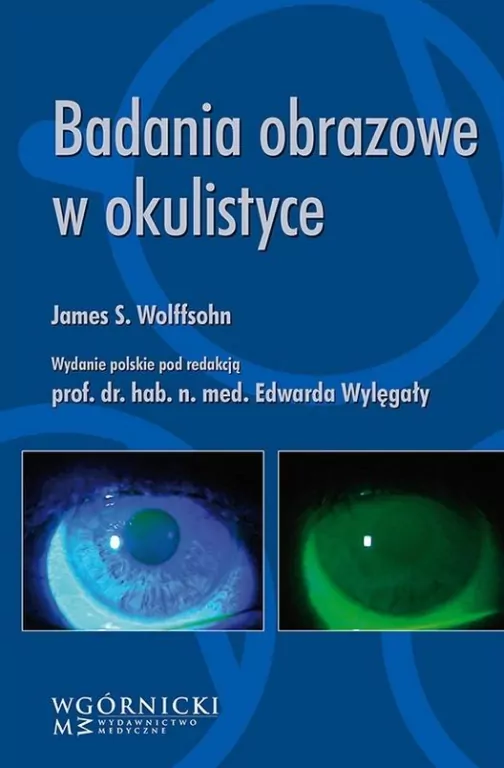 Badania obrazowe w okulistyce - tantis.pl