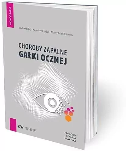 Choroby zapalne gałki ocznej. Poradnik lekarza - tantis.pl