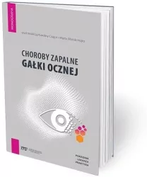 Choroby zapalne gałki ocznej. Poradnik lekarza