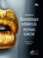 StyleItaliano. Stomatologia odtwórcza. Przypadki kliniczne - tantis.pl