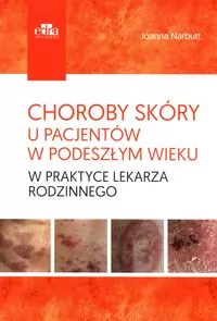 Choroby skóry u pacjentów w podeszłym wieku - tantis.pl
