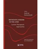 Metastatic Disease in the Liver - Current Therapeutic Approaches - tantis.pl