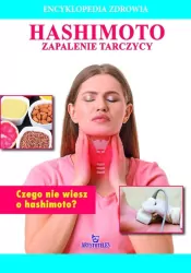 Hashimoto. Zapalenie tarczycy. Encyklopedia zdrowia