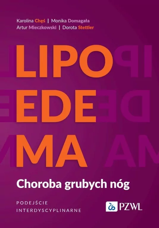 Lipoedema - tantis.pl