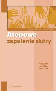 Atopowe zapalenie skóry. Poradnik lekarza praktyka - tantis.pl