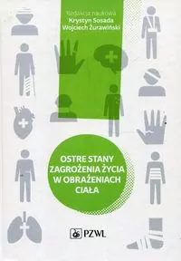 Ostre stany zagrożenia życia w obrażeniach ciała - tantis.pl