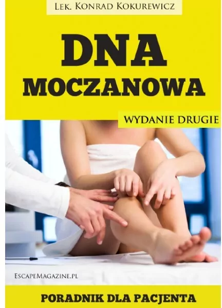 Dna moczanowa. Poradnik dla pacjenta - tantis.pl