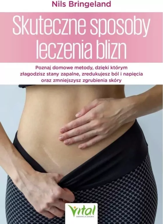Skuteczne sposoby leczenia blizn - tantis.pl