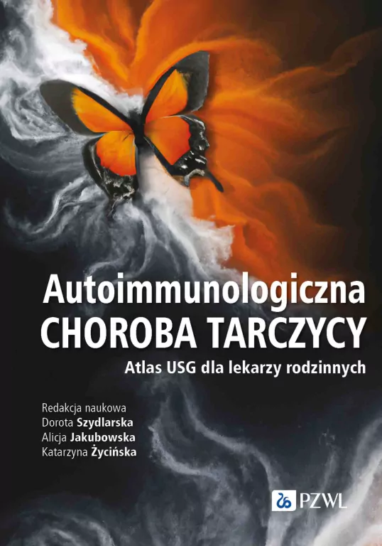 Autoimmunologiczna choroba tarczycy. Atlas USG - tantis.pl