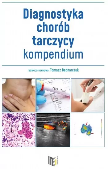 Diagnostyka chorób tarczycy. Kompendium - tantis.pl