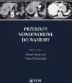 Przerzuty nowotworowe do wątroby - tantis.pl