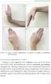 Smart Hand Model. Diagnoza i terapia ręki u dzieci - tantis.pl