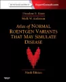 Atlas of Normal Roentgen Variants That May Simulate Disease - tantis.pl