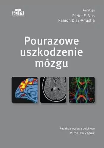 Pourazowe uszkodzenie mózgu - tantis.pl