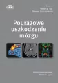 Pourazowe uszkodzenie mózgu - tantis.pl