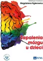 Zapalenia mózgu u dzieci - tantis.pl