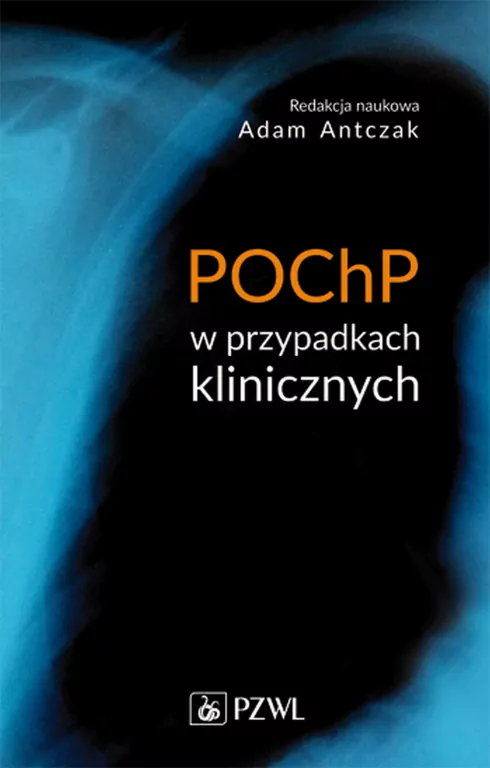 POChP w przypadkach klinicznych - tantis.pl