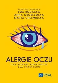 Alergie oczu. Ilustrowane kompendium dla praktyków - tantis.pl