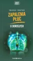 Zapalenia płuc u dorosłych - tantis.pl