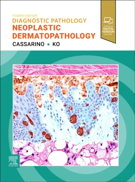 Diagnostic Pathology. Neoplastic Dermatopathology - tantis.pl