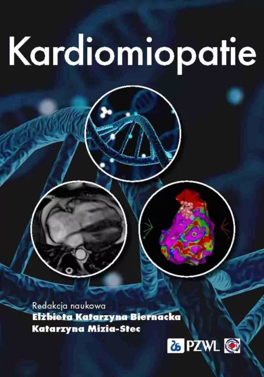Kardiomiopatie - tantis.pl