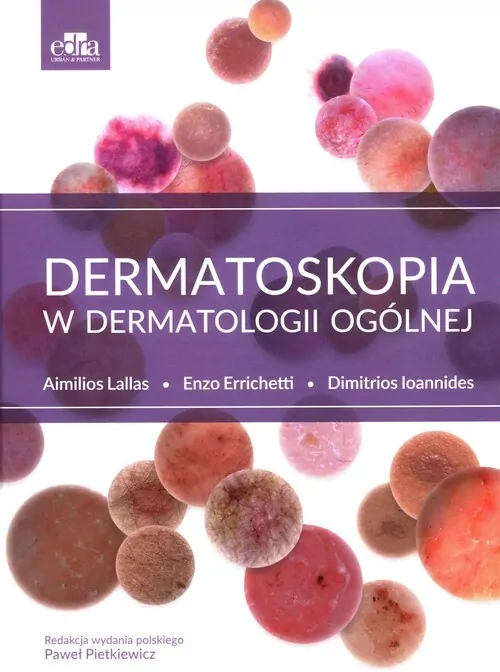 Dermatoskopia w dermatologii ogólnej - tantis.pl