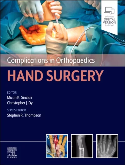 Complications in Orthopaedics. Hand Surgery - tantis.pl