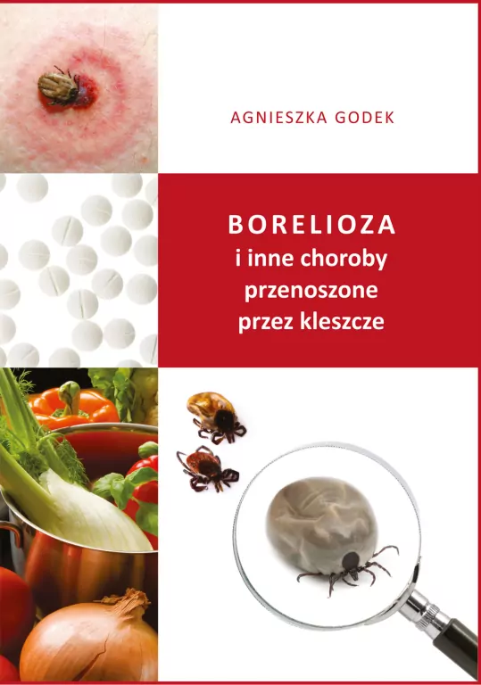 Borelioza i inne choroby przenoszone przez kleszcze - tantis.pl